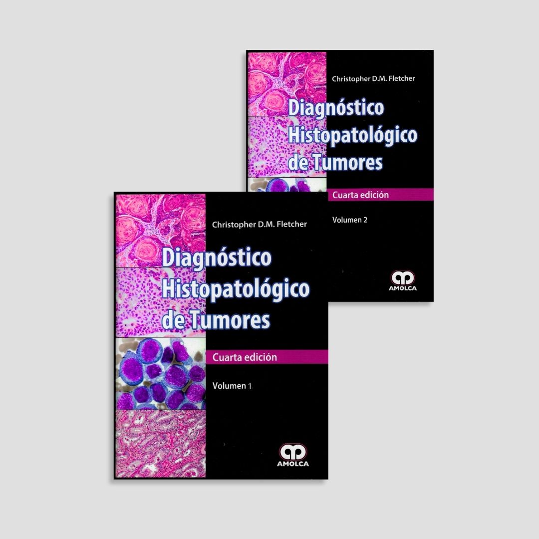 Diagnóstico Histopatológico de Tumores