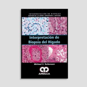 Interpretación de Biopsia del Hígado