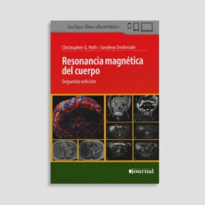 Resonancia Magnética del Cuerpo