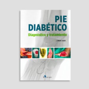 Pie diabético