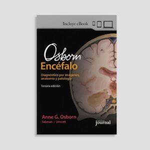 Osborn. El Encéfalo