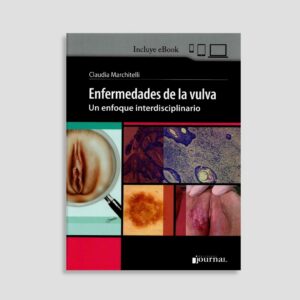 Enfermedades de la vulva