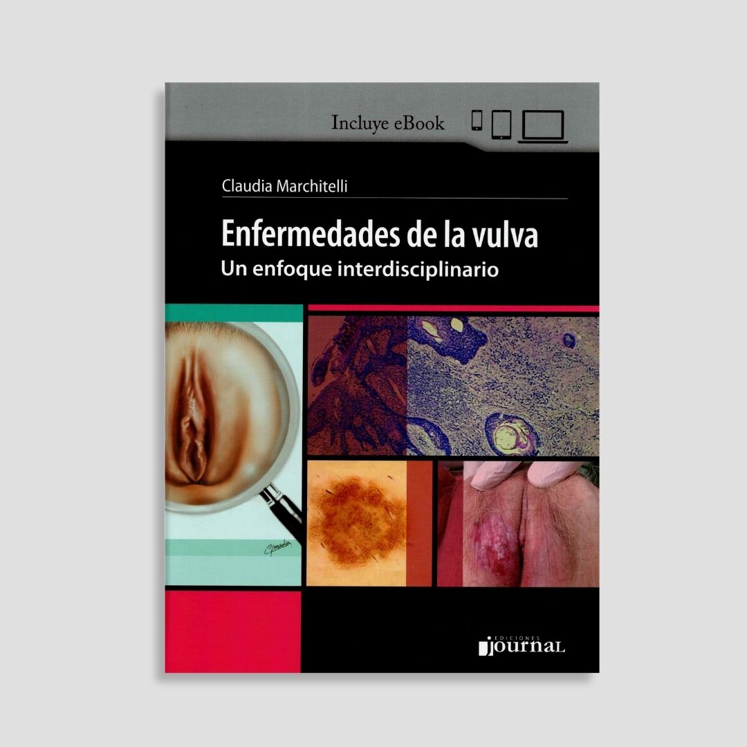 Enfermedades de la vulva