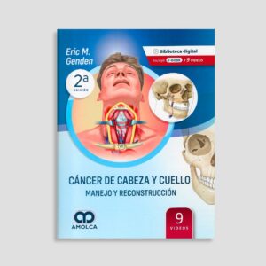 Cáncer de Cabeza y Cuello - Manejo y Reconstrucción