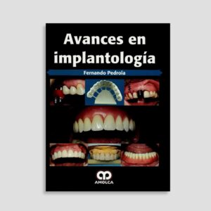 Avances en Implantología