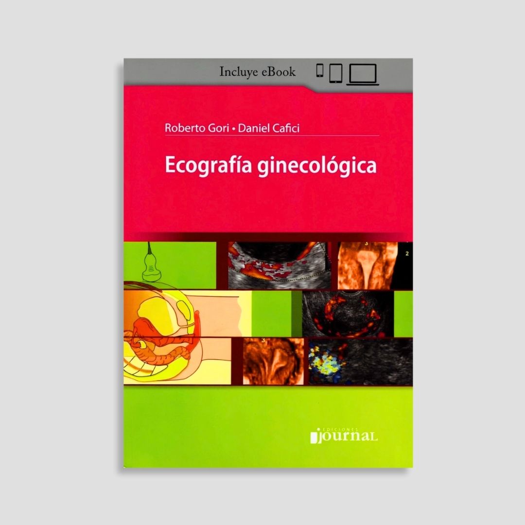 Ecografía Ginecológica