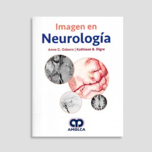 Imagen en Neurología