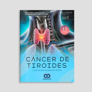 Cáncer de Tiroides