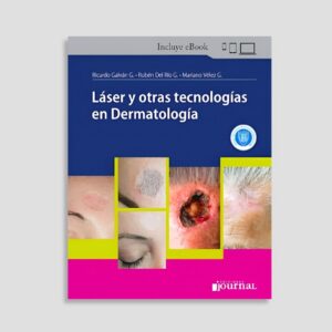 Láser y otras tecnologías en Dermatología