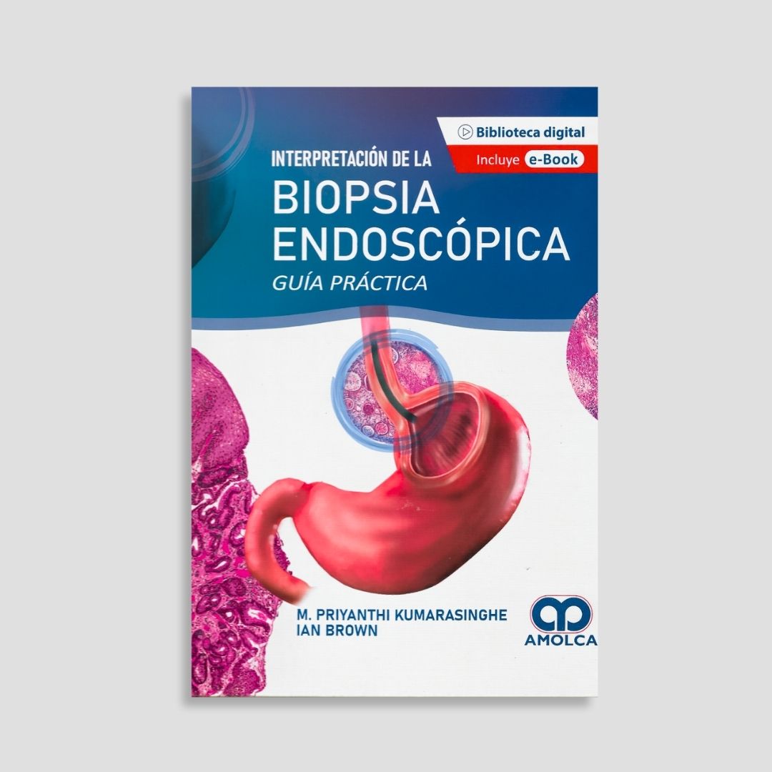 Interpretación de la Biopsia Endoscópica