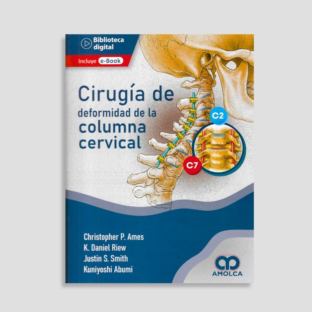 Cirugía de deformidad de la Columna Cervical