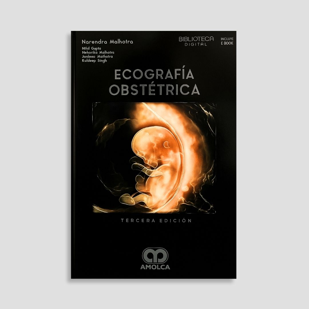 Ecografía obstétrica