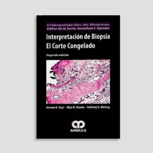 Interpretación de Biopsia el Corte Congelado