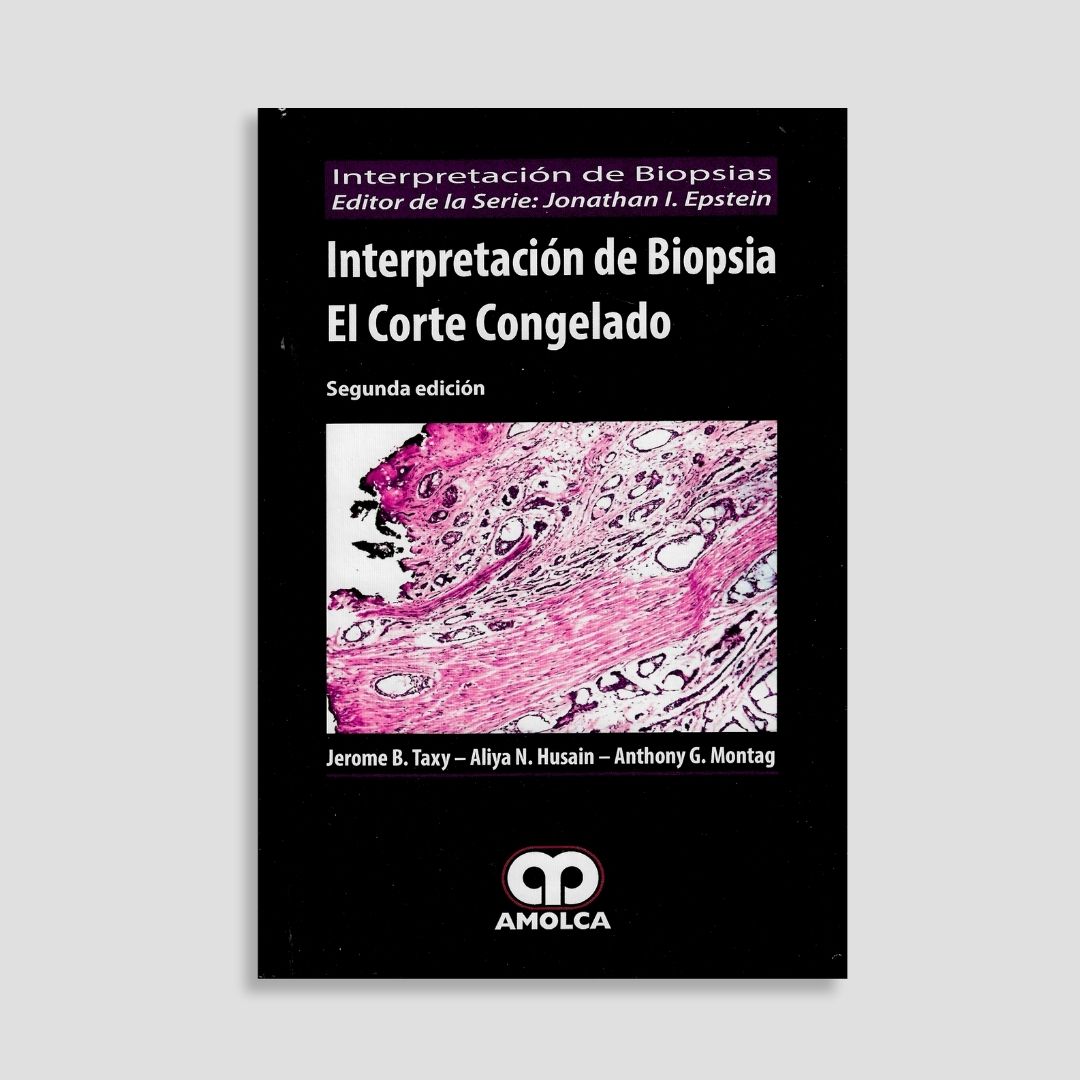 Interpretación de Biopsia el Corte Congelado