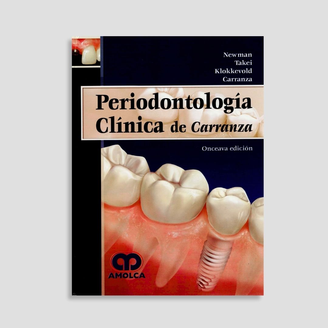 Periodontología Clínica de Carranza