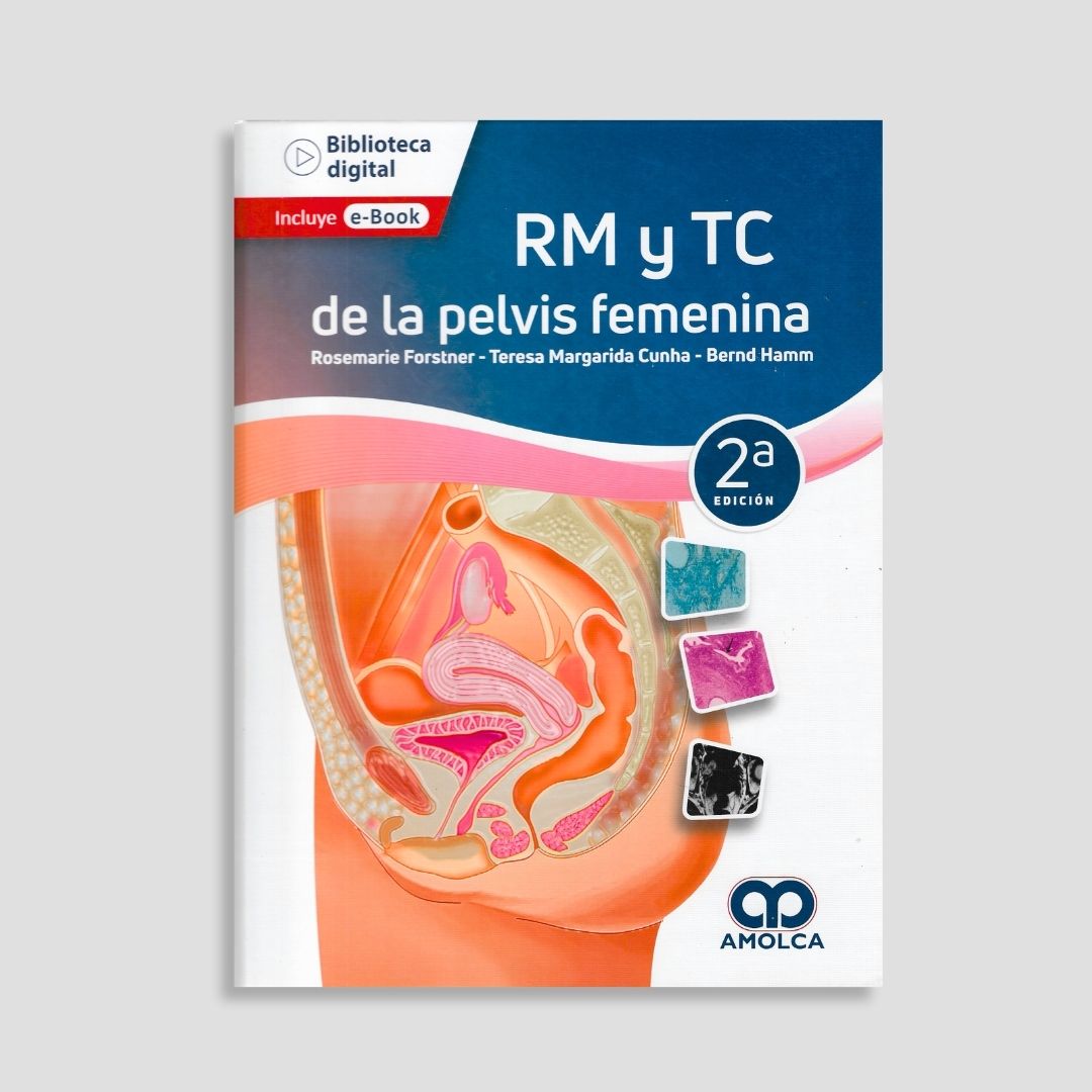 RM y TC de la pelvis femenina