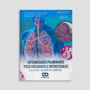 Enfermedades pulmonares poco frecuentes e intersticiales