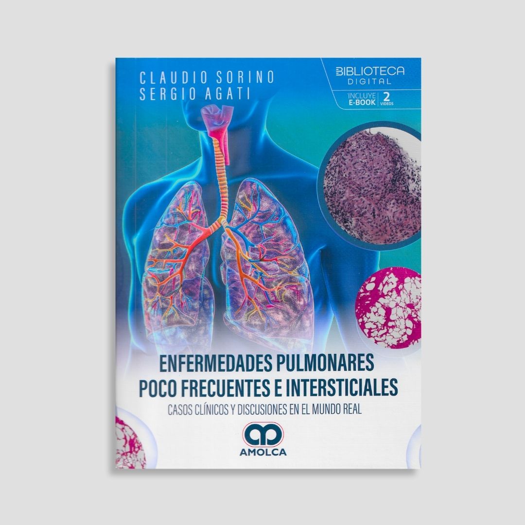 Enfermedades pulmonares poco frecuentes e intersticiales