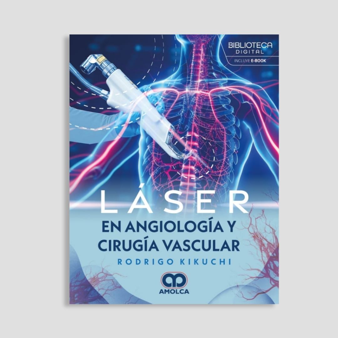 Cirugía Vascular