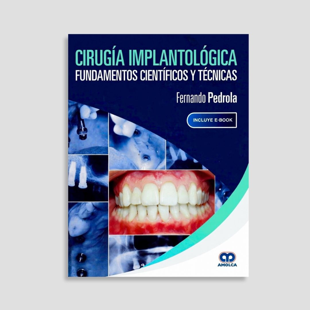 Cirugía Implantológica. Fundamentos Científicos y Técnicas