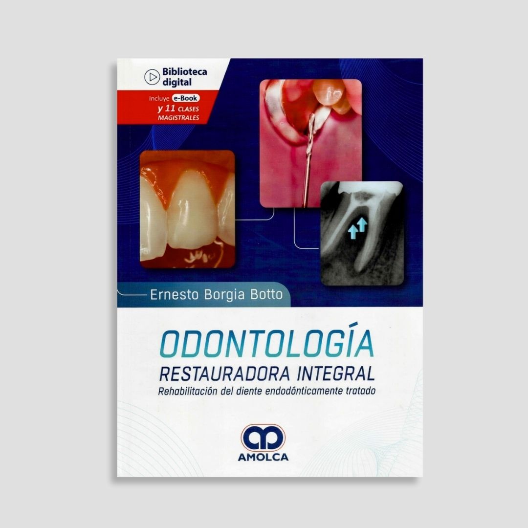 Odontología restauradora integral