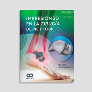 Impresión 3D en la cirugía de pie y tobillo