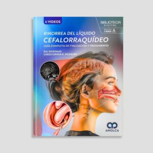 Rinorrea del líquido cefalorraquídeo