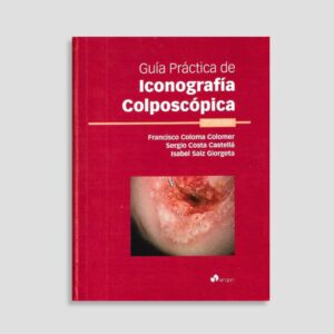 Guía práctica de Iconografía colposcópica
