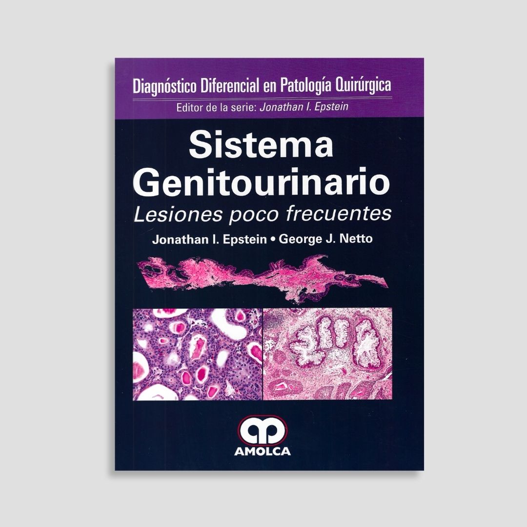 Diagnóstico Diferencial en Patología Quirúrgica Sistema Genitourinario