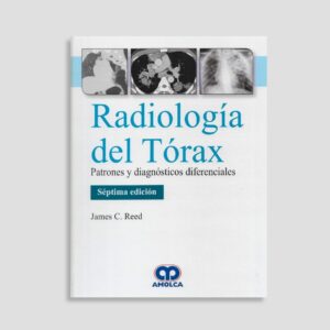 Radiología del Tórax. Patrones y Diagnósticos Diferenciales