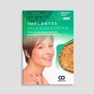 Implantes en la zona estética