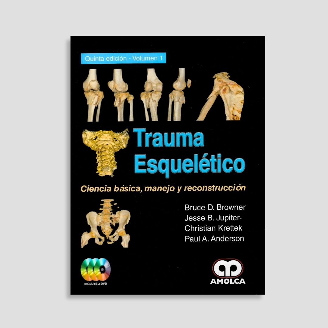 Trauma esquelético - Image 2
