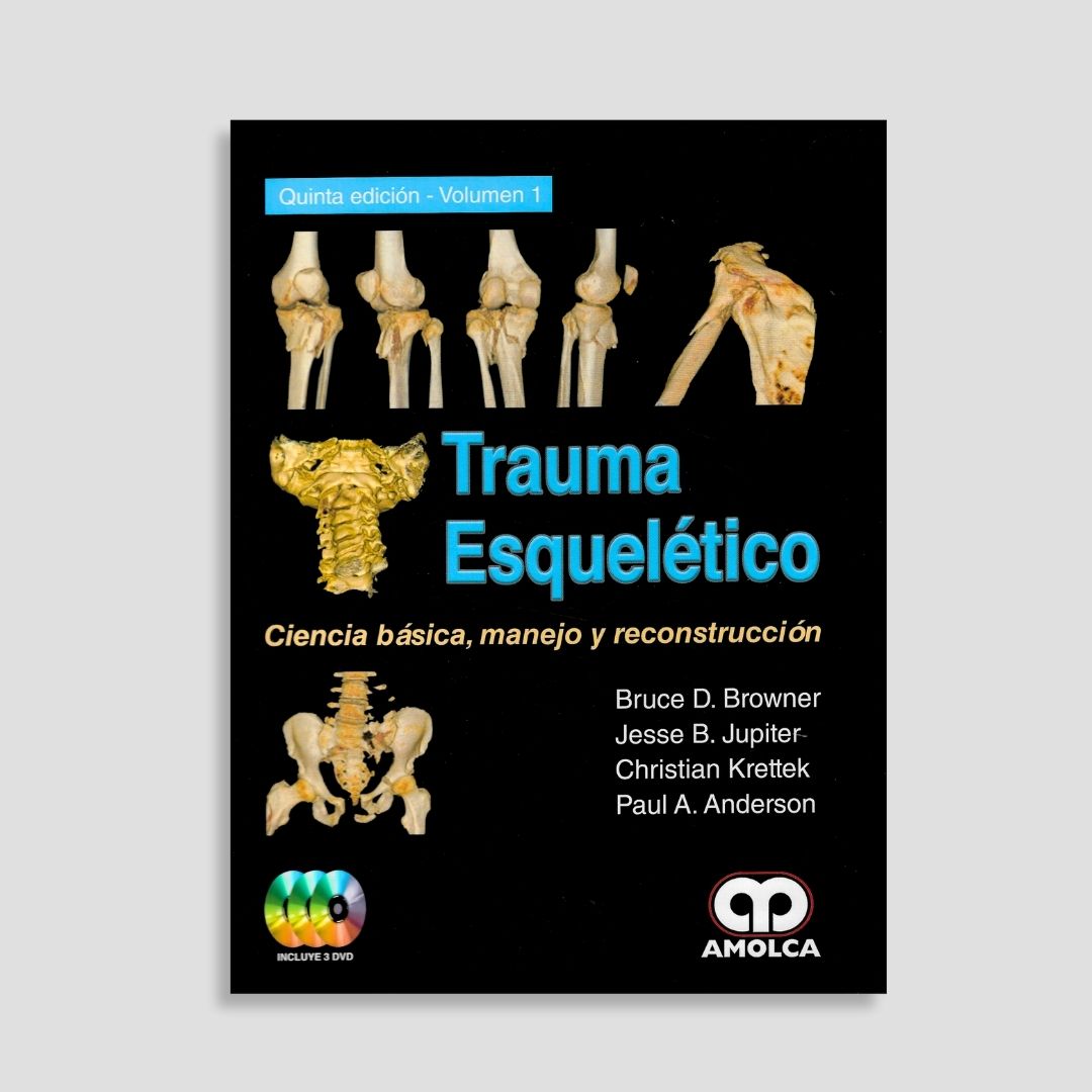 Trauma esquelético - Image 4