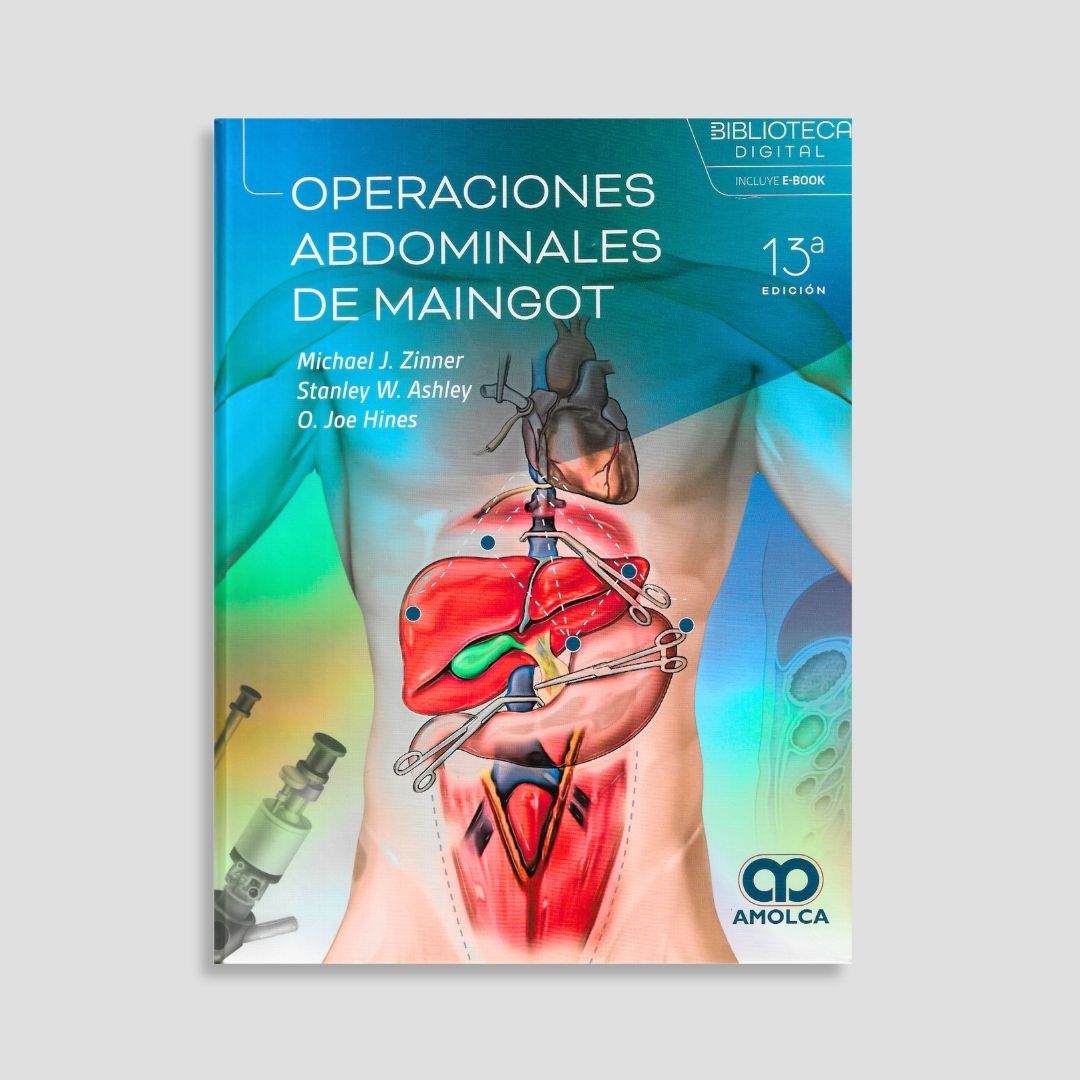 Operaciones abdominales de Maingot