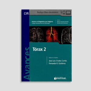 Avances en Diagnóstico por Imágenes: Tórax 2