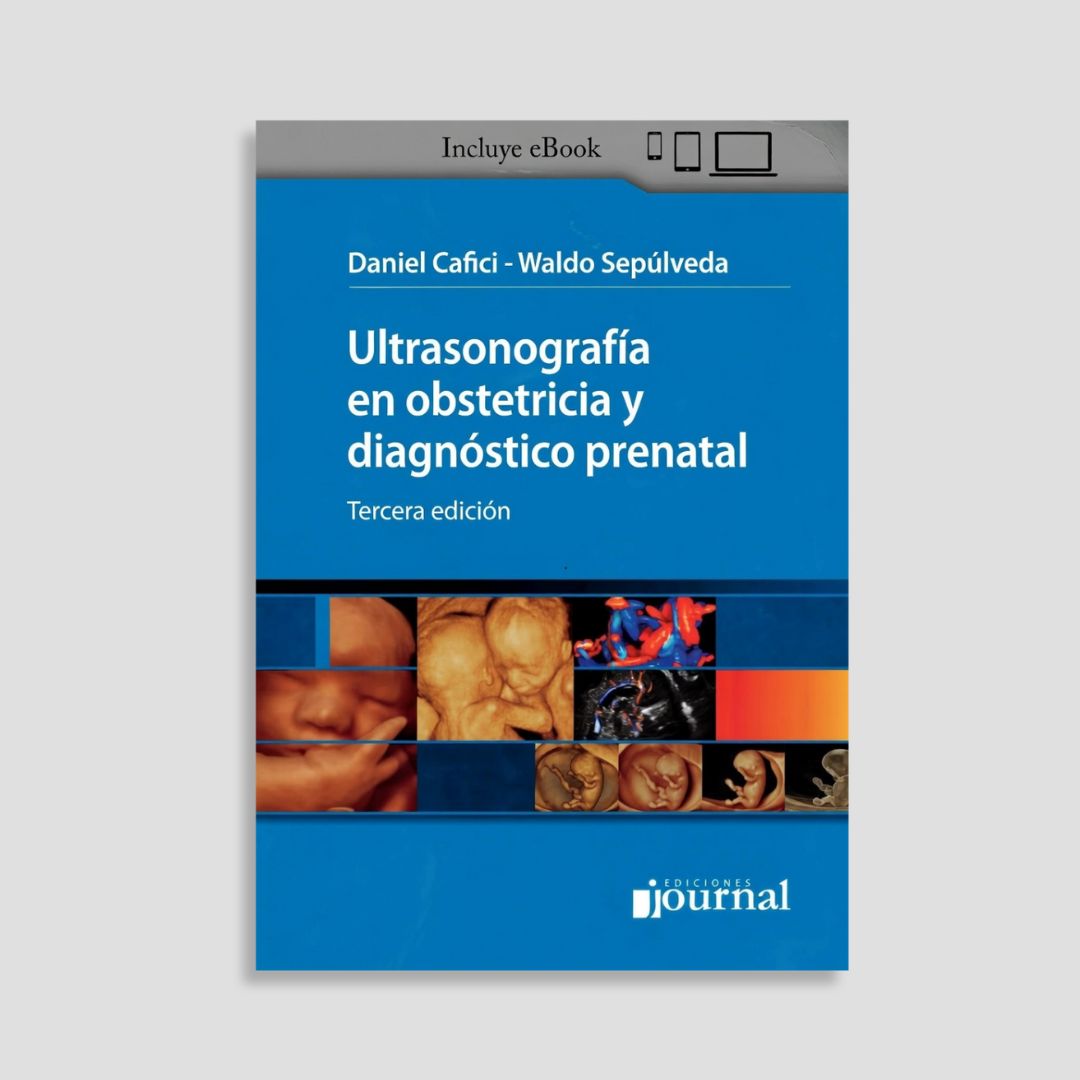 Ultrasonografía en Obstetricia y Diagnóstico Prenatal