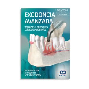 Exodoncia avanzada. Técnicas y enfoques clínicos modernos