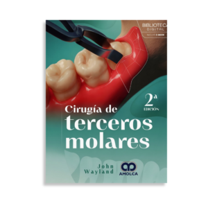 Cirugía de terceros molares
