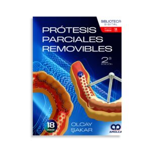 Prótesis parciales removibles