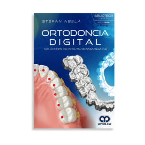 Ortodoncia digital. Soluciones terapéuticas innovadoras
